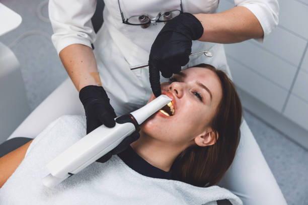 Best Teeth Whitening  in Mirrormont, WA